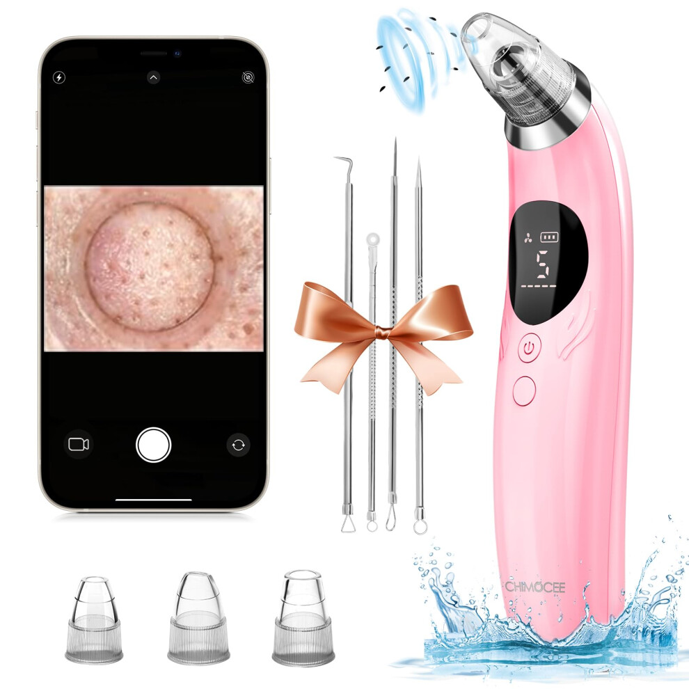 Blackhead Remover Vacuum with 1080P Camera, 69Kpa Suction, 3 Levels, 3 Probes, Pink Rechargeable Tool