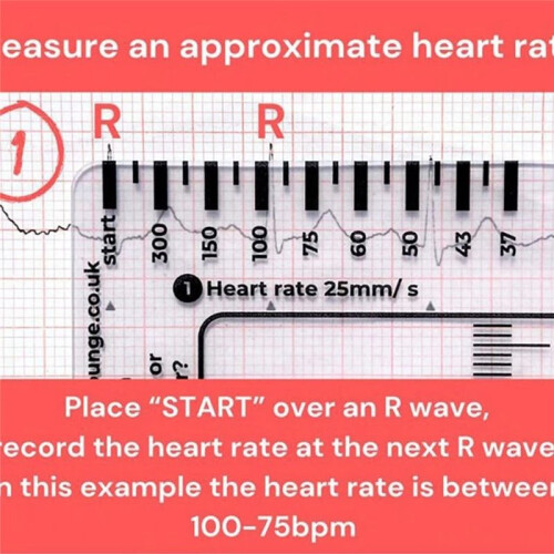 ECG 7 Step Ruler ECG Ruler Plastic Ruler Measuring Tool for ECG/EKG Interpretation Easy-to-Carry with 1 Protect Sheath 2