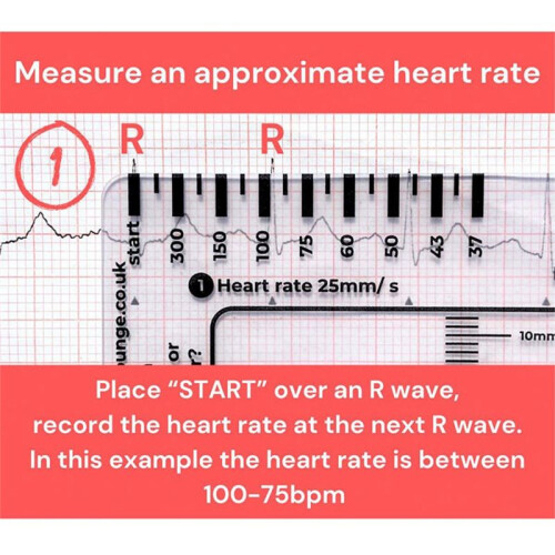 2pcs ECG 7 Step Ruler,ECG 7 Step Ruler for ECG/EKG Interpretation,ECG Reference Guide Ruler,EKG Calipers Measuring Tool 1