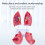 Modèle d'anatomie pulmonaire normale, modèle anatomique humain 2