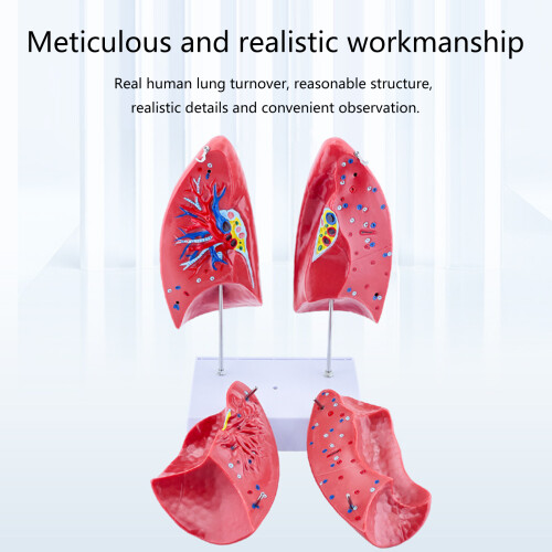 Modèle d'anatomie pulmonaire normale, modèle anatomique humain 1