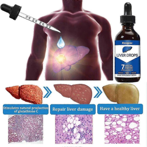 (3PCS) 1-3x Liver Drops Body Treatment 1