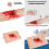 Reusable Medicals Training Skin Module Easy to Clean Wearable 2