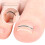 10-Pack Toenail Correction Patches for Ingrown Nails – Thin, Flexible Silver Design  16 mm 5