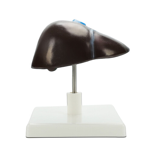 Anatomical Hepatic Structure Model Education Teaching Tool for