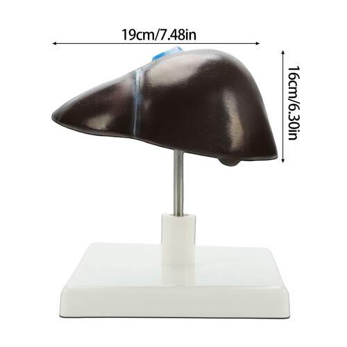 Anatomical Hepatic Structure Model Education Teaching Tool for 2