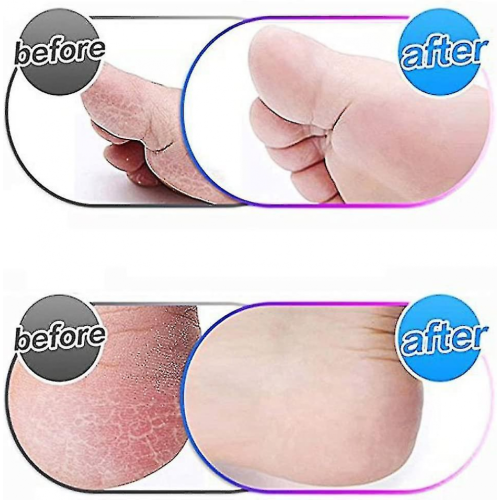 [4-pack] Extra grove vervangende rollers Compatibel met Emjoi Micro Pedi vervangende rollers 2
