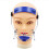 Inverted Jaw Facial Chin Correction 1