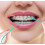 Idontix X-Floss Lite, Μπλε 3