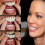 Instant Smile Comfort Fit Flex cosmetic teeth for upper and lower dentures_Lucky_B 1