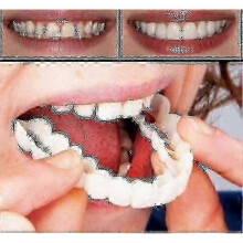 A Pair Upper Lower High Quality Denture Instant Smile Comfort Fit Flex Cosmetic Teeth Denture Teeth Top_Lucky_B