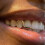 Trendy Horizontal Bar Teeth Jewelry Double-A silver set 6