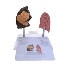 Smoker Lung And Healthy Lung Anatomical Model For Teaching PVC