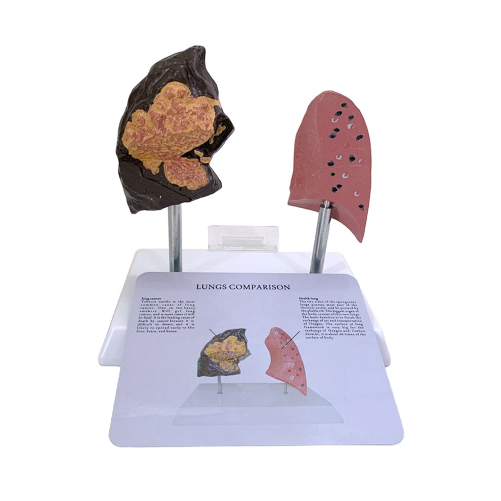 Smoker Lung And Healthy Lung Anatomical Model For Teaching PVC