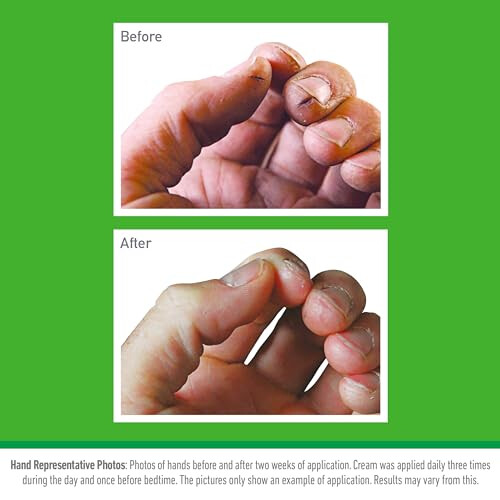 O'Keeffe's? Working Hands Value Size Jar 193g, packaging may vary 2