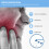 AntiSnoring Jaw Support, Bite Splint, Night Mouth Guard, Teeth Grinding Protector 2