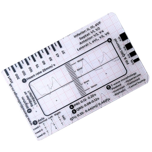 Electrocardiogram interpretation manual for electrocardiogram 7 Stieflwerdekarte for an efficient interpretation