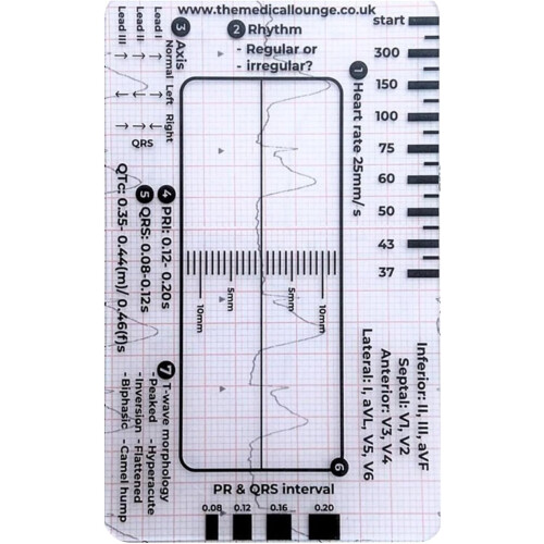 Electrocardiogram interpretation manual for electrocardiogram 7 Stieflwerdekarte for an efficient interpretation 1