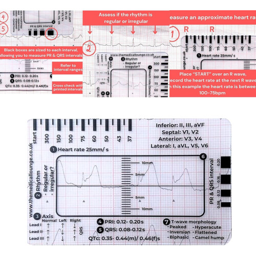 Electrocardiogram interpretation manual for electrocardiogram 7 Stieflwerdekarte for an efficient interpretation 2