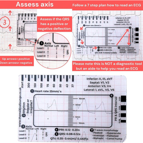 Electrocardiogram Reference Manual Electrocardiogram 7 Step Ruler Cards Electrocardiogram Interpretation Manual Ref: 4647 2
