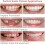 2 Pairs Fake Teeth  Bottom Artificial Dentures White Cosmetic Teeth 3