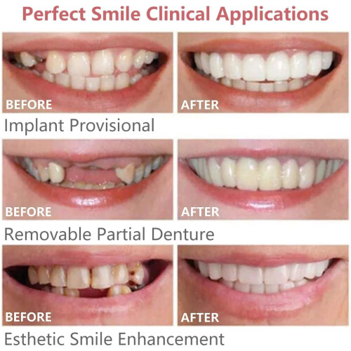 2 Pairs Fake Teeth  Bottom Artificial Dentures White Cosmetic Teeth 2