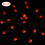 String Lights For Valentine's Day, Heart-Shaped LED Decor With Eight Lighting Modes, Auto Timer Function For Hassle-Free Festive Moods 3