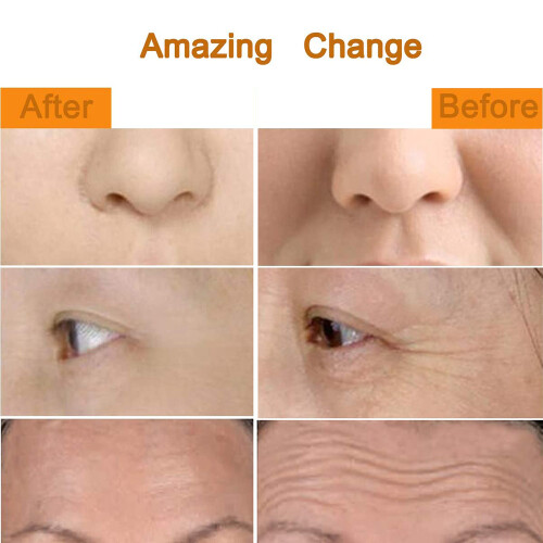 Body Sharper & Face Lift: Τρισδιάστατος κύλινδρος μασάζ με ζύμωμα για μια εντελώς φυσική 2