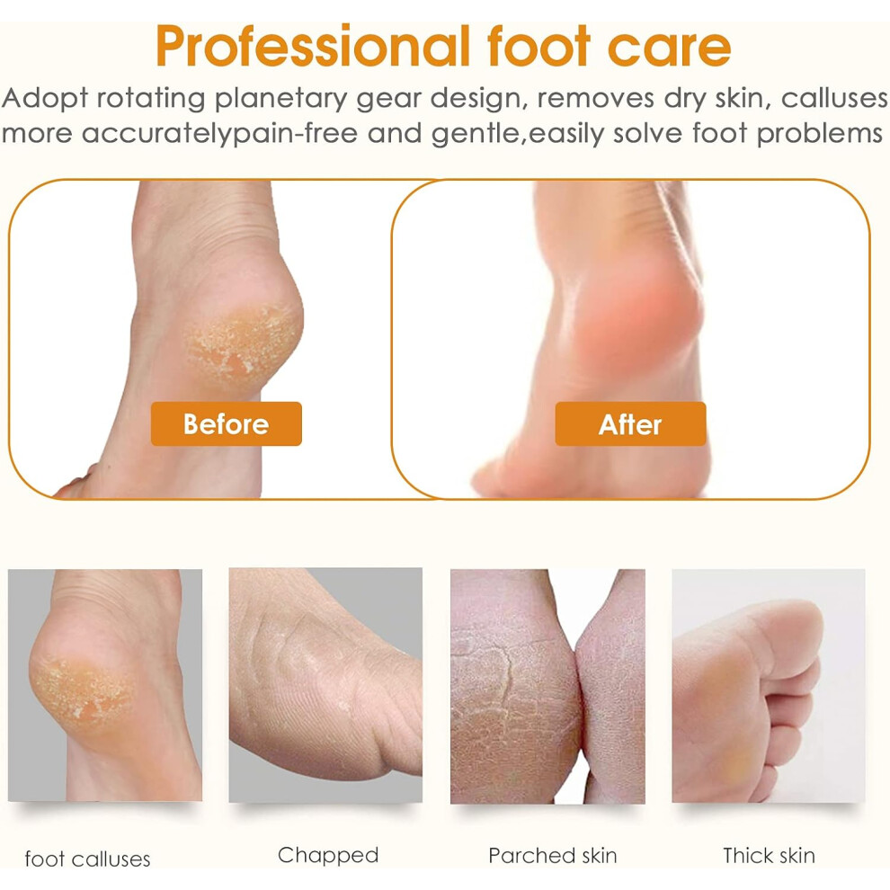 Professional Pedi Feet Care, Electric Callus Removers Rechargeable Portable Electronic Foot File Pedicure Tools for Dead Hard Cracked Dry Skin,