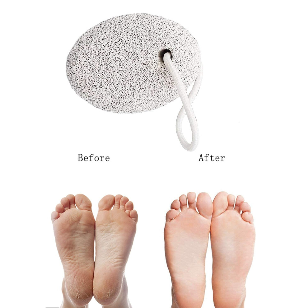 Exfoliating Oval Pumice Stone, Natural Lava Foot Care Scrubber For Removing Dead Skin, Convenient Design Pedicure Tool That Relieves Fatigue And