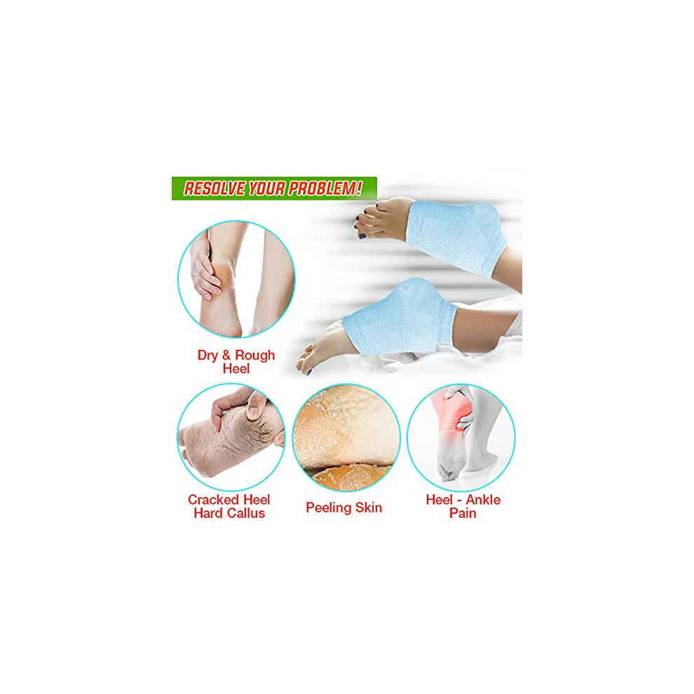 Revitalizing Heel Care Solution, Cracked Heel Treatment with Aloe Vera Gel Socks for Dry Cracked Feet, Comfortable & Breathable Design for Men and