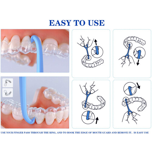 Πακέτο Smile Saver, Εργαλείο αφαίρεσης ευθυγραμμιστών υγιεινού σχεδιασμού, 1