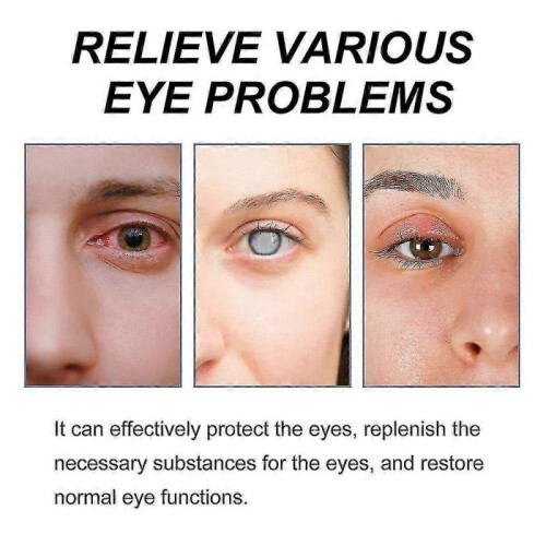 Ximonth Relieves Eye Fatigue Eyedrops 2
