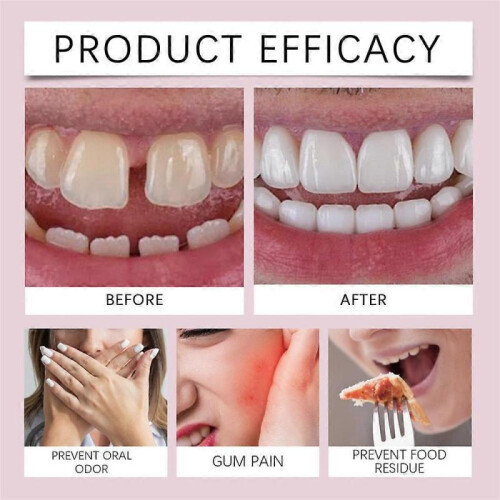 JEREMYTIS Thermoplastic Denture Adhesive 1