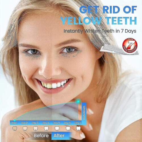 5d Teeth Whitening Strips, Safe And Rapid Teeth Whitening Strips, Sensitive Teeth Whitening Strips 2