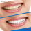 5d Teeth Whitening Strips, Safe And Rapid Teeth Whitening Strips, Sensitive Teeth Whitening Strips 5