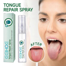 (2pcs)Tongue Repair Spray 30ml Reduce Swelling Tongue Relief Treatment Spray for Bad Breath, Tongue Repair Spray for Dryness& Bad Breath