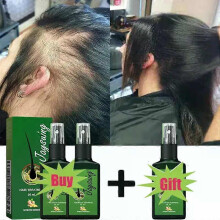 (Buy 2 get 1 free)Fast Hair Growth Serum Spray Anti Hair Loss Prevent Baldness Scalp Treatment Repair Roots Beauty Health Hair Care For Men Women