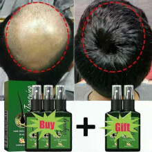 (Buy 3 get 2 free)Fast Hair Growth Serum Spray Anti Hair Loss Prevent Baldness Scalp Treatment Repair Roots Beauty Health Hair Care For Men Women