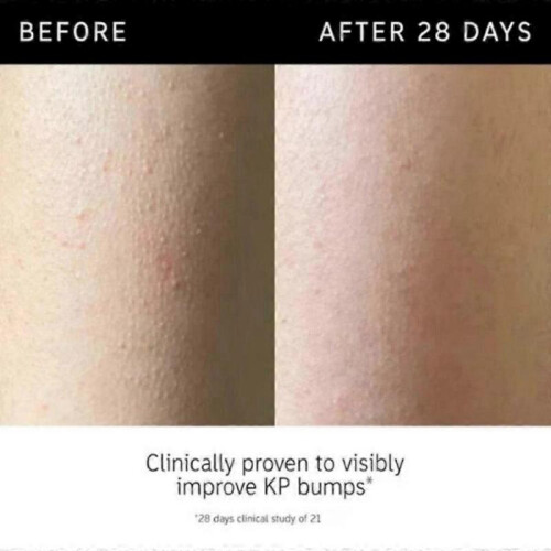 (3pcs)List Glycolic Acid Exfoliating Body Stick 45g 1