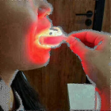 "Red Light Therapy for 2025's Newest Model Of Tooth Sores, Relieving Gingivitis with Led Technology"