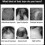 5 Extra Strength Men Hair Regrowth Solution Retail Box 5