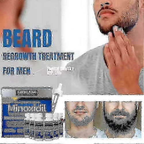 5 Extra Strength Men Hair Regrowth Solution Retail Box 1