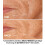 Εργαλείο περιποίησης δέρματος Microneedling, κιτ μικροβελόνων με αντικαταστάσιμη 8