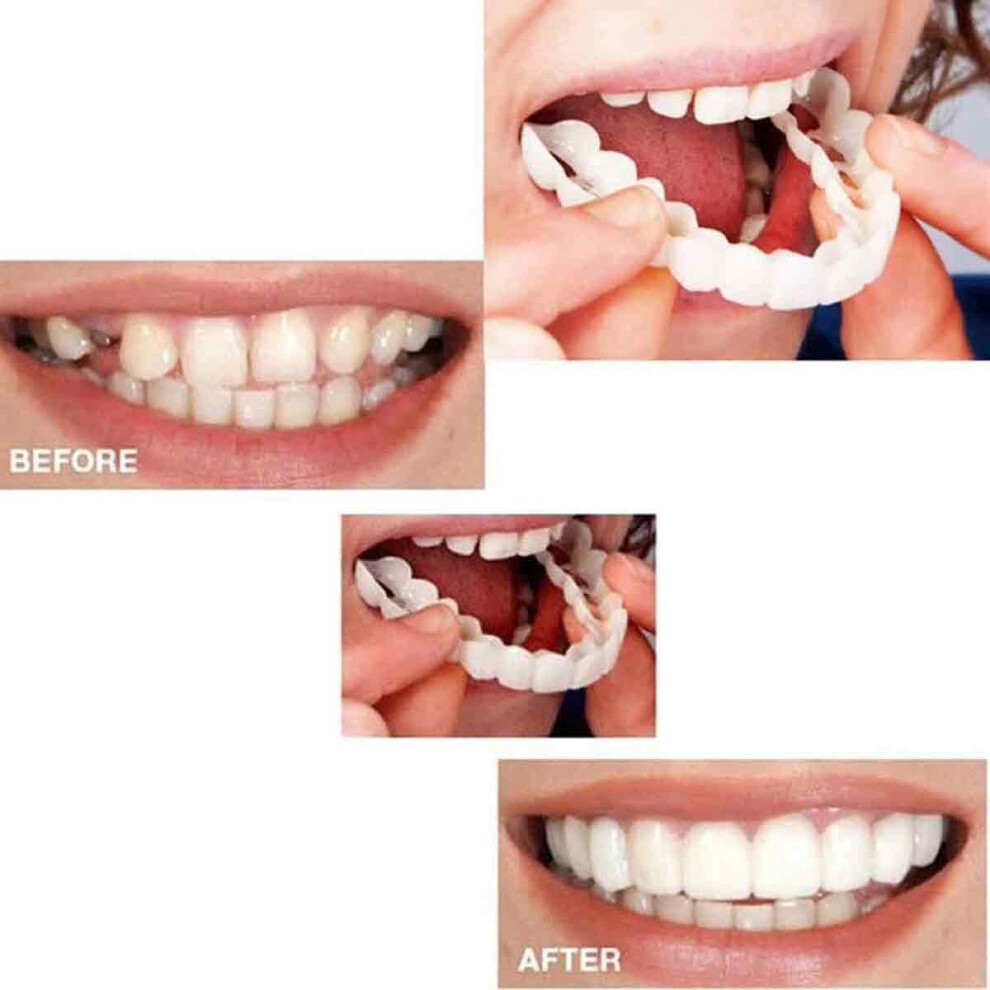 Instant Smile Transformation, Whitening Veneer for Shielding Deformed Teeth with Comfort Fit, Highly Recommended Customizable Teeth Covers, Reliable