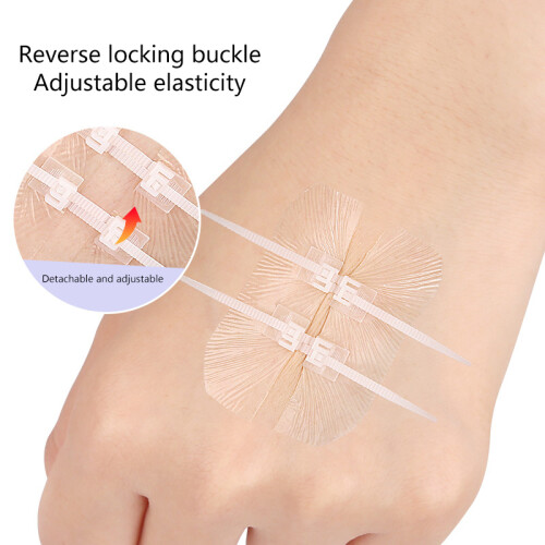 1 pièce pour attache à fermeture éclair, patch de fermeture éclair, pansement pour blessure, suture rapide pour plaisir en extérieur, patch 2