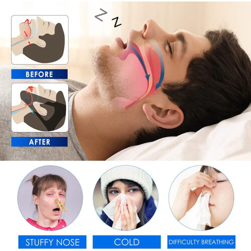 Anti Snoring Nose Spray, Deep Relax Sleep Spray, AntiSnoring Solution 2