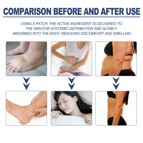 Constipation Belly Patch 150Pcs: Herbal Relief for Digestive Issues 2