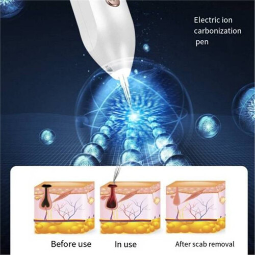 Mole Point Pen Household Spot Micro-Current Mole Removal Tool Ionized Carbonization Nine Grade Beauty Instrument 2