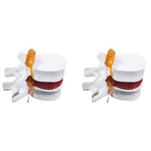 2X Human Anatomy Skeleton Spine Lumbar Disc Herniation Teaching Model Brain Skull Traumatic School Supplies Instrume